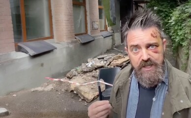 У Києві на американського режисера-документаліста впав балкон