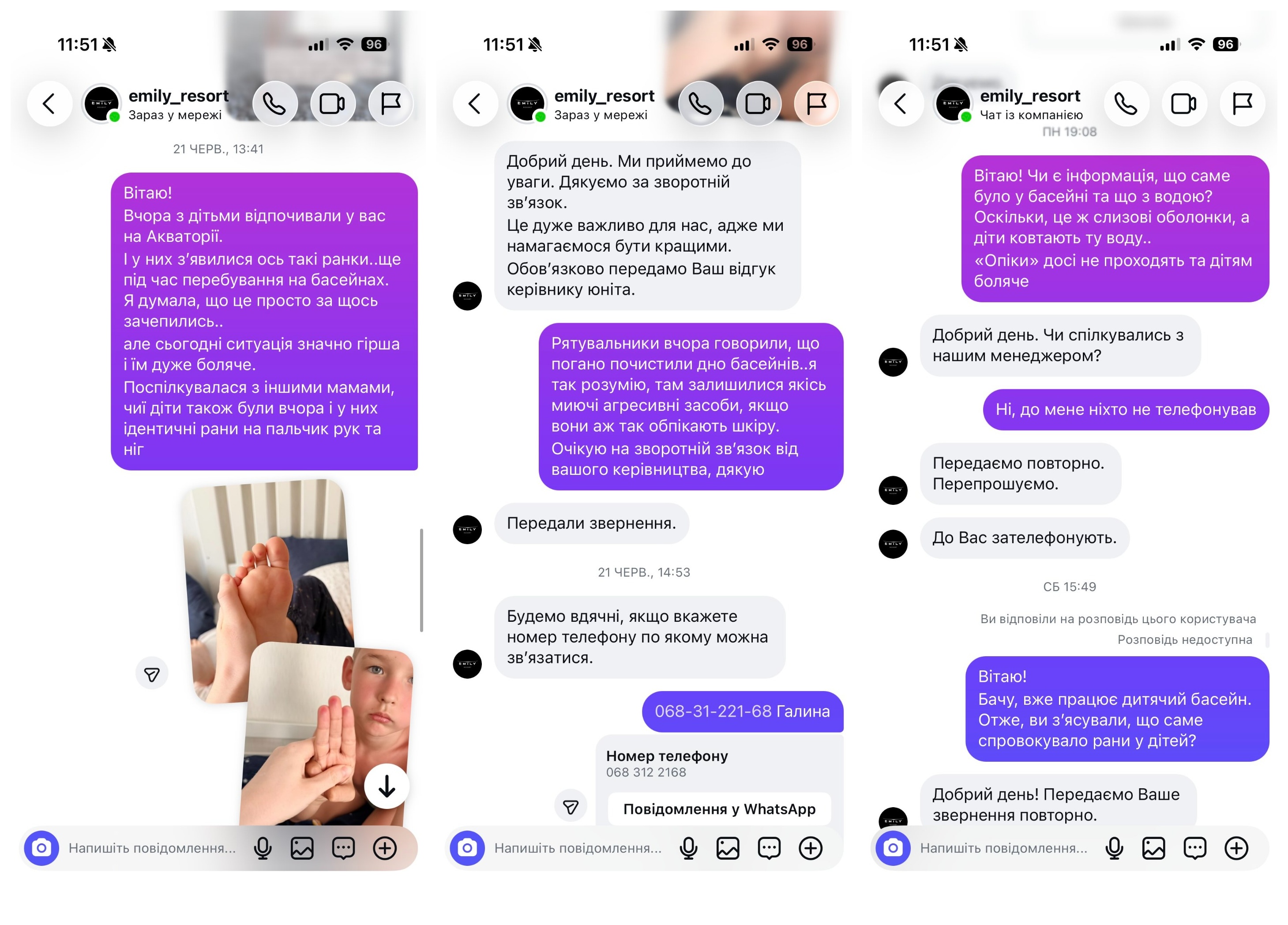 Після відвідування дитячого басейну Emily Resort у Винниках під Львовом у дітей з'явилися болючі ранки фото 1